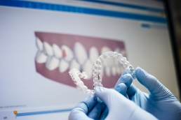 Why You’re Likely an Ideal Candidate for Invisalign - 1